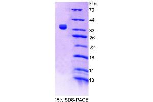 SDS-PAGE (SDS) image for 3'(2'), 5'-Bisphosphate Nucleotidase 1 (BPNT1) (AA 2-308) protein (His tag) (ABIN6239518) (BPNT1 Protein (AA 2-308) (His tag))