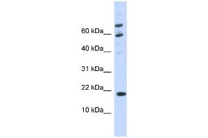 WB Suggested Anti-C21orf87 Antibody Titration:  0. (BRWD1-AS2 antibody  (C-Term))