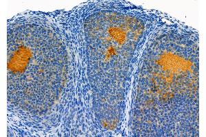 ABIN6265954 and ABIN6272483 at 1/100 staining Rat ovarian tissue by IHC-P.