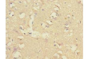 Immunohistochemistry of paraffin-embedded human brain tissue using ABIN7148480 at dilution of 1:100 (CNTNAP1 antibody  (AA 20-300))