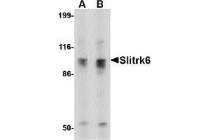 Western Blotting (WB) image for anti-SLIT and NTRK-Like Family, Member 6 (SLITRK6) (C-Term) antibody (ABIN1030685) (SLITRK6 antibody  (C-Term))