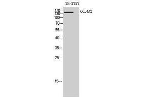 Western Blotting (WB) image for anti-Collagen, Type IV, alpha 2 (COL4A2) (N-Term) antibody (ABIN3174485) (COL4a2 antibody  (N-Term))