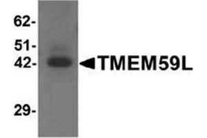 Western blot analysis of TMEM59L in rat heart tissue lysate with TMEM59L antibody at 1 μg/mL
