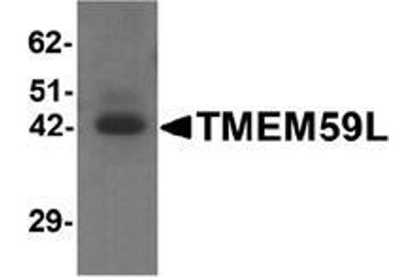 TMEM59L antibody  (C-Term)