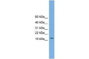 WB Suggested Anti-MAGEA5  Antibody Titration: 0. (MAGEA5 antibody  (N-Term))
