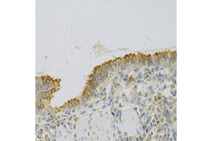 Immunohistochemistry of paraffin-embedded rat lung using PA2G4 Antibody (ABIN5973112) at dilution of 1/100 (40x lens). (PA2G4 antibody)