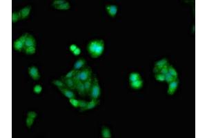 Immunofluorescent analysis of HepG2 cells using ABIN7153886 at dilution of 1:100 and Alexa Fluor 488-congugated AffiniPure Goat Anti-Rabbit IgG(H+L) (Glucocorticoid Receptor antibody  (AA 1-190))