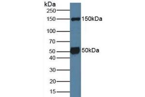Detection of SGK1 in Mouse Brain Tissue using Polyclonal Antibody to Serum/Glucocorticoid Regulated Kinase 1 (SGK1) (SGK1 antibody  (AA 145-386))