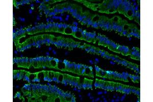 human duodenum (courtesy of L. (Cytokeratin 19 antibody)