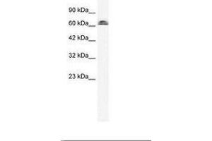Image no. 2 for anti-Influenza Virus NS1A Binding Protein (IVNS1ABP) (AA 47-96) antibody (ABIN6735955) (IVNS1ABP antibody  (AA 47-96))