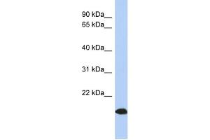 WB Suggested Anti-ARL17 Antibody Titration: 0. (ARL17 antibody  (Middle Region))