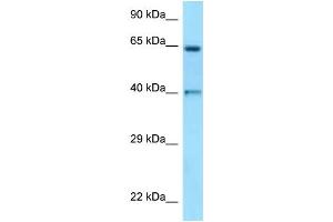 WB Suggested Anti-ANGPT1 Antibody Titration: 1. (Angiopoietin 1 antibody  (N-Term))