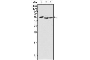 Western Blot showing PTK6 antibody used against Hela (1), A549 (2) and MCF-7 (3) cell lysate.