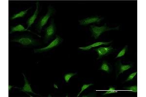 Immunofluorescence of monoclonal antibody to SERPINA3 on HeLa cell.