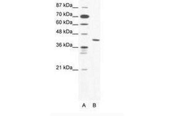 ZNF621 antibody  (AA 208-257)