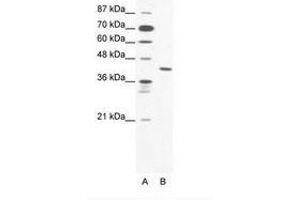 Image no. 1 for anti-Zinc Finger Protein 621 (ZNF621) (AA 208-257) antibody (ABIN203142) (ZNF621 antibody  (AA 208-257))