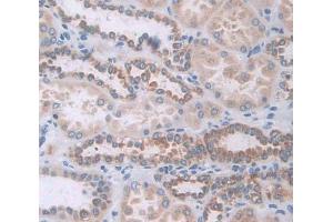 IHC-P analysis of Kidney tissue, with DAB staining.