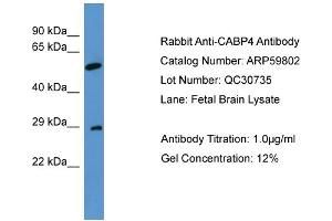 WB Suggested Anti-CABP4  Antibody Titration: 0. (CABP4 antibody  (N-Term))