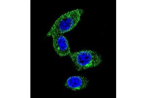 Confocal immunofluorescent analysis of SORBS1 Antibody (Center) (ABIN654646 and ABIN2844342) with MDA-M cell followed by Alexa Fluor 488-conjugated goat anti-rabbit lgG (green). (SORBS1 antibody  (AA 866-892))