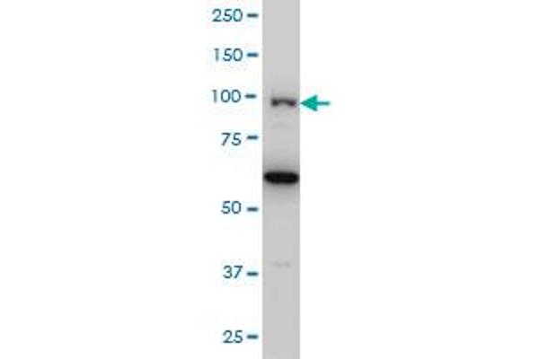 OCRL anticorps  (AA 146-239)