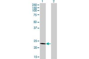 Western Blot analysis of RCV1 expression in transfected 293T cell line by RCV1 monoclonal antibody (M09), clone 4E2.