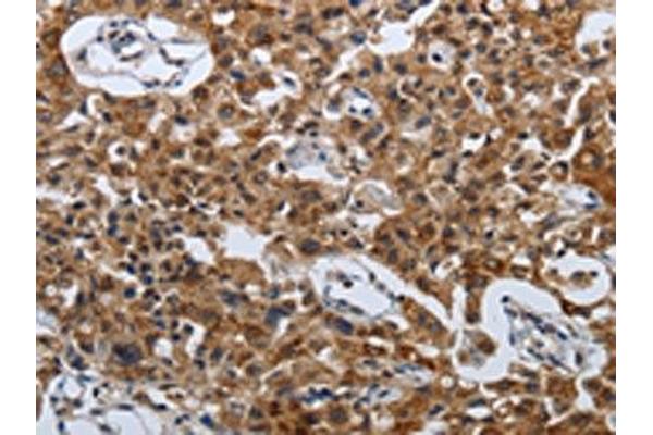 SPAG4 antibody