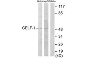 Western blot analysis of extracts from HeLa/HepG2 cells, using CELF-1 Antibody. (CELF1 antibody  (AA 71-120))