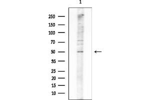 anti-erythrocyte Membrane Protein Band 4.9 (Dematin) (EPB49) (C-Term) antibody
