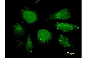 Immunofluorescence of purified MaxPab antibody to GDF3 on HeLa cell.