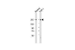 All lanes : Anti-DOCK8 Antibody (C-Term) at 1:2000 dilution Lane 1: Ramos whole cell lysate Lane 2: THP-1 whole cell lysate Lysates/proteins at 20 μg per lane. (DOCK8 antibody  (AA 2056-2090))