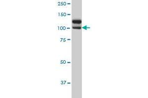 NEK9 monoclonal antibody (M01), clone 1F6 Western Blot analysis of NEK9 expression in HeLa . (NEK9 antibody  (AA 226-326))