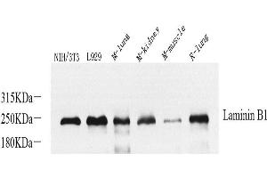 Western Blot analysis of various samples using Laminin beta1 Polyclonal Antibody at dilution of 1:800. (Laminin beta 1 antibody)