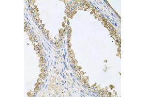 Immunohistochemistry of paraffin-embedded human prostate using HSP90AA1 antibody at dilution of 1:100 (x40 lens). (HSP90AA1 antibody)