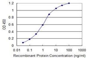 Detection limit for recombinant GST tagged AATF is 0. (AATF antibody  (AA 151-250))