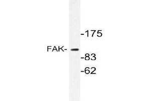 Western blot (WB) analyzes of FAK antibody in extracts from HT-29 cells. (FAK antibody)