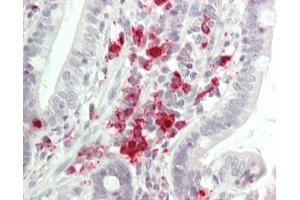 Immunohistochemistry (Paraffin-embedded Sections) (IHC (p)) image for anti-Transforming Growth Factor, beta Receptor II (70/80kDa) (TGFBR2) (AA 517-567) antibody (ABIN2629105)