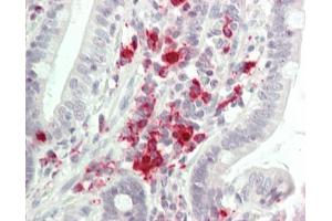Human Small Intestine: Formalin-Fixed, Paraffin-Embedded (FFPE) (TGFBR2 antibody  (AA 517-567))