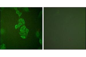 Immunofluorescence analysis of A549 cells, using NSE antibody. (ENO2/NSE antibody)