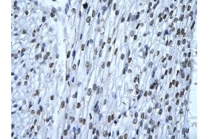 Immunohistochemistry (IHC) image for anti-X-Ray Repair Complementing Defective Repair in Chinese Hamster Cells 6 (XRCC6) (N-Term) antibody (ABIN2778270)