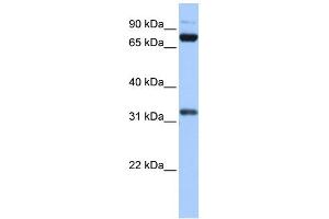 WB Suggested Anti-TAF6 Antibody Titration:  0. (TAF6 antibody  (C-Term))