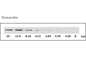 Image no. 3 for Epidermal Growth Factor Receptor (EGFR) ELISA Kit (ABIN625237) (EGFR ELISA Kit)