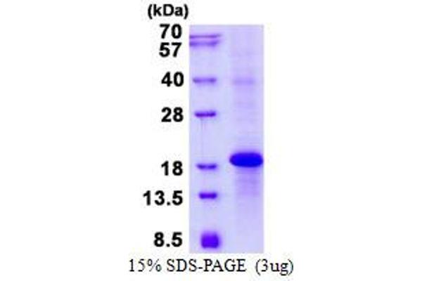 KLRC3 Protein (His tag)