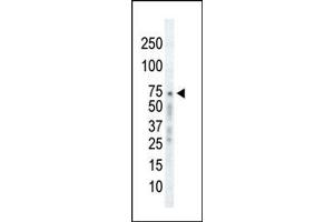 Western blot analysis of anti-GRK2 C-term Pab (ABIN1882061 and ABIN2841168) in Ramos cell lysate. (GRK2 antibody  (C-Term))