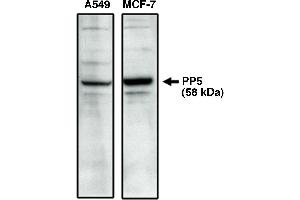 Western blot analysis using PP5 specific antibody on A549 and MCF-7 cell lysates. (PP5.2 antibody  (C-Term))