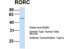 Host:  Rabbit  Target Name:  RORC  Sample Type:  Human Fetal Muscle  Antibody Dilution:  1. (RORC antibody  (Middle Region))