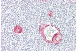 Anti-MAP3K5 / ASK1 antibody IHC staining of human thymus. (ASK1 antibody  (AA 49-98))