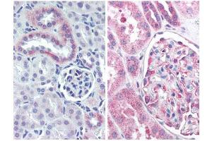 Immunohistochemistry (IHC) image for anti-Nestin (NES) (AA 1484-1500) antibody (ABIN104564)