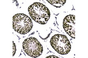 IHC analysis of SAE2/UBA2 using anti-SAE2/UBA2 antibody . (UBA2 antibody  (AA 449-564))