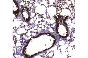 IHC testing of FFPE mouse lung tissue with Carboxylesterase 1 antibody at 1ug/ml. (CES1 antibody)