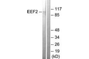 Western blot analysis of extracts from NIH-3T3 cells, treated with serum 10% 30', using eEF2 (Ab-56) Antibody. (EEF2 antibody  (AA 31-80))